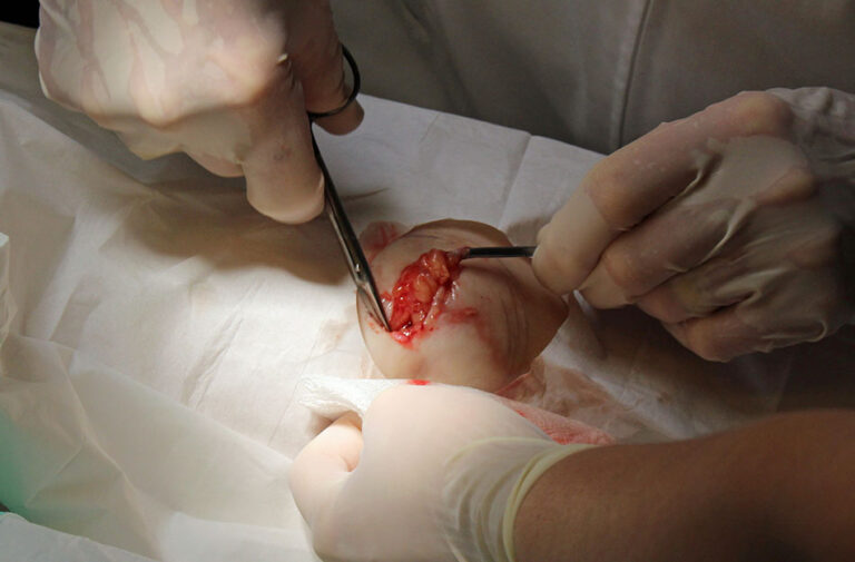 South Florida Surgery